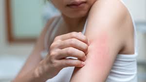 Kulit Sudah Rajin Dibersihkan, Tapi Kenapa Masih Bermasalah?